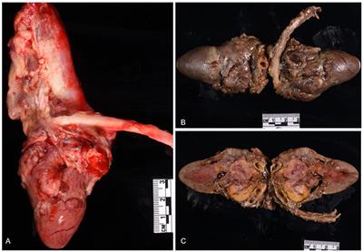 Case report: Malignant chemodectoma with hepatic metastasis in a cat